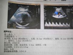 绍兴助孕中介官网：b-ultrasound右上角的字母MF可以区分男性和女性，所有试用过